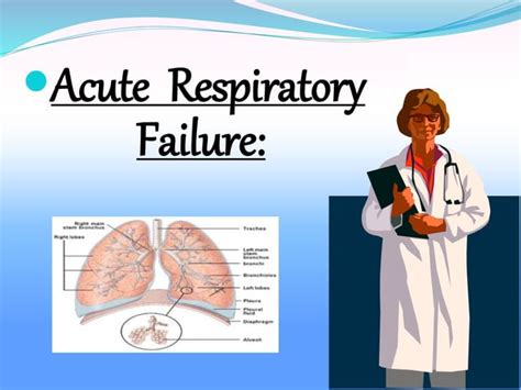 Acute respiratory failure in a rapidly.